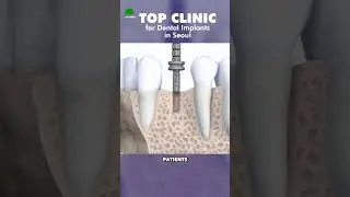 Top clinic for Dental Implants in Seoul