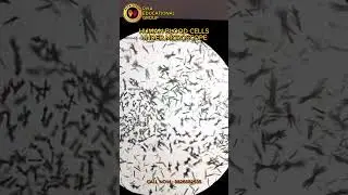 Human Blood Cell under Microscope | Blood Cell | #viral #experiements #ytshorts #education #sahsir