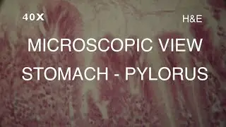 MICROSCOPIC VIEW - STOMACH PYLORUS