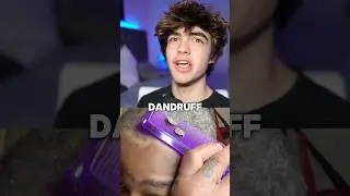 How to get rid of dandruff 😱🤝