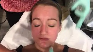 Chernoff Cosmetic Surgeons: (Speed) Vitalize Peel