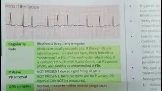 Cardiac monitoring 🫀#nursinglover 