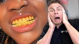 5 Things To Avoid YELLOW Teeth RIGHT NOW! 🦷😮