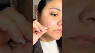 Peace Out Acne Dot Gunk Reveal 👏