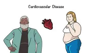 Reducing Cardiovascular Risk For Those With Diabetes