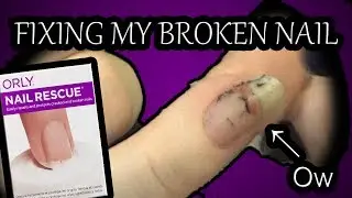 Fixing My Broken Nail (Also an ORLY Nail Rescue Product Review!)