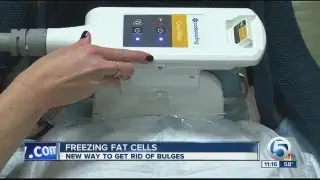 Freezing  fat cells