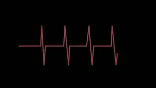 Heart monitor sound effect for december (1st OF DECEMBER SPECIAL! 1️⃣)