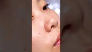 ASMR Deep Facial Cleaning | Electric Suction Blackhead Extraction Close-U