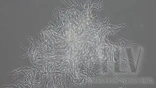 Clostridium perfringens  -ウエルシュ菌-