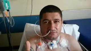 PERBONY ANTES  E DEPOIS DA OPERA&Ccedil;&Atilde;O ..