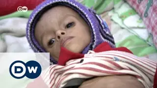 Jemen: Hungerkrise bedroht Millionen Kinder | DW Nachrichten