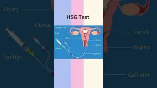 #hsgtest kya hai ? #pregnancy #health #amazing #viral #youtubeshorts