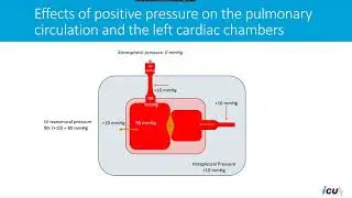Effects of positive pressure on the pulmonary circulation and the left cardiac chambers