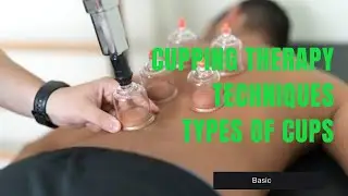 Cupping therapy ll Techniques ll Types of cups