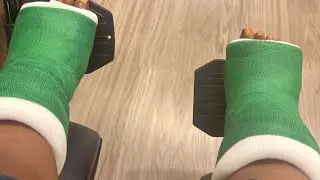 Cast removal: watch me get a new pair.