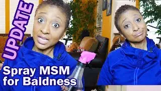 SPRAY MSM for BALDING/THINNING - UPDATE / TV Blake Review