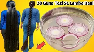 This Onion Remedy Trick Really 100% Works!🔥 Fastest Thick Hair Growth In 7 Days🤩