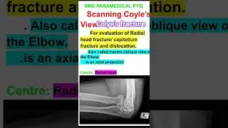 COLEY'S VIEW || COLEY'S PROJECTION ||