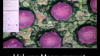 hirox 3D digital microscopy: 3D profiling measurement