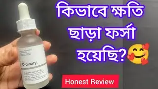 The Ordinary Hyaluronic Acid 2% + B5 Serum Bangla review/How to use Hyaluronic Acid serum.