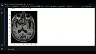 2.2 - Cropping | SimpleITK - Course MRI preprocessing with Python