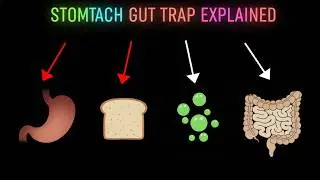 The Secret Stomach Fold That Traps Food And Creates Toxic Gas