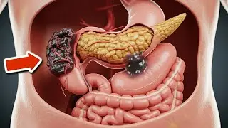 7 ранних признаков рака, о которых большинство людей не знают💥