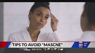 Tips to avoid mask acne