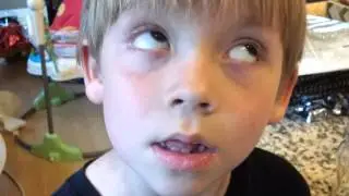 Eye rolling