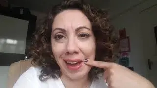 Um ano após a paralisia de bell
