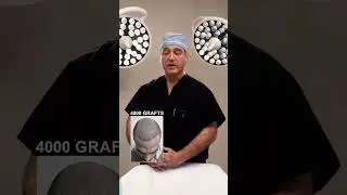 Q&A: Why is my hair falling out after the surgery?