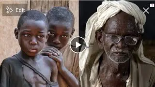 Talauci na sanadiyyar salwantar rayukan mafiya yawan ma su fama da shi a Nigeria da sauran kasashe