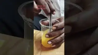 Vestige calcium Demo