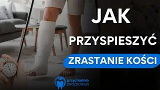 Jak PRZYSPIESZYĆ zrastanie KOŚCI po ZŁAMANIU? Ręka, noga, obojczyk – CO JEŚĆ i czego UNIKAĆ