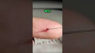 Это просто БЕЗУМИЕ! Берри-хирургия! 🤯