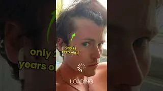 SAVING MY RECEDING HAIRLINE! 🤯🔥 #hair #shorts