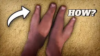 Secrets of the Zimbabwean Tribe with 2 Toes: A Rare Genetic Phenomenon!
