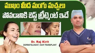 Why Pigmentation Occurs On Face | Best Treatment for Melasma on Face | Celestee Skin And Hair Clinic