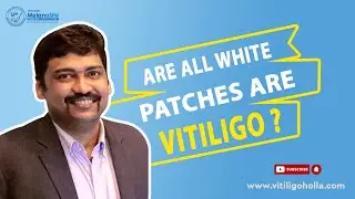 All white patches are not vitiligo - Understanding Vitiligo | Dr. A P Holla | MelanoSite.