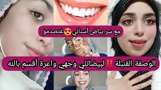الوصفة لبيضاتلي وجهي واعرة اقسم بالله💯من بعد معاناة سر بياض أسناني غتصدمو جير كامل غيطيح