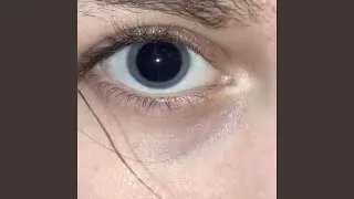Junkie