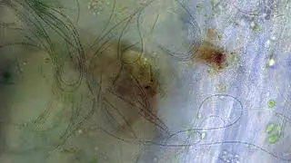 Beggiatoa - sulfur bacteria extended cut - Relaxing/Studying - Microscopy