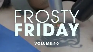 Dense Black Ink Chest Tattoo Removal | Frosty Friday Volume 10 | Removery