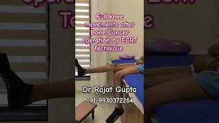 Happy patient after#bonecancer #osteosarcoma operation by ECRT Technique -Dr Rajat Gupta