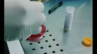 ENDOTRACHEAL FLUID CULTURE MICROBIOLOGY 🧫🩺#newvideo #microbiology #culture #lab #bacteria #micro