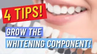 4 tips to grow the whitening component of your Dental Practice