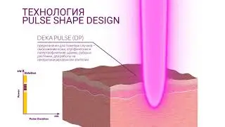 Deka SmartXIde Punto - новий лазер з оптимізованими можливостями