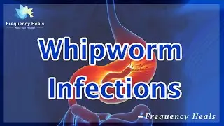 Relieve Whipworm Infections - Energy & Quantum Medicine - Healing Frequency - Raise Vibrations