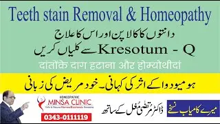 Teeth Stain Removal || Fikr-e-Farda